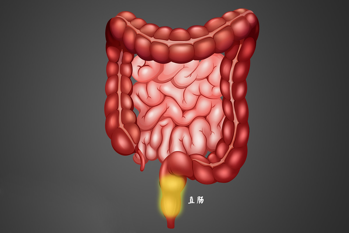 急性直肠炎的不治会导致哪些危害?